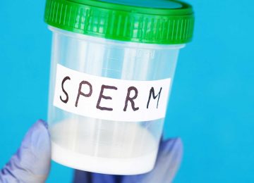 Flacon-de-recueil-de-sperme